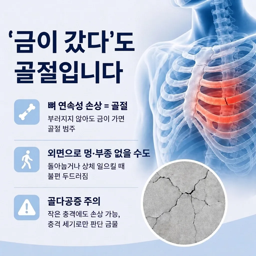 뼈의 연속성 손상이 골절이며 겉보기에 멍이나 부종이 없을 수 있고 골다공증이 있으면 작은 충격에도 손상될 수 있음을 정리한 갈비뼈 균열 일러스트