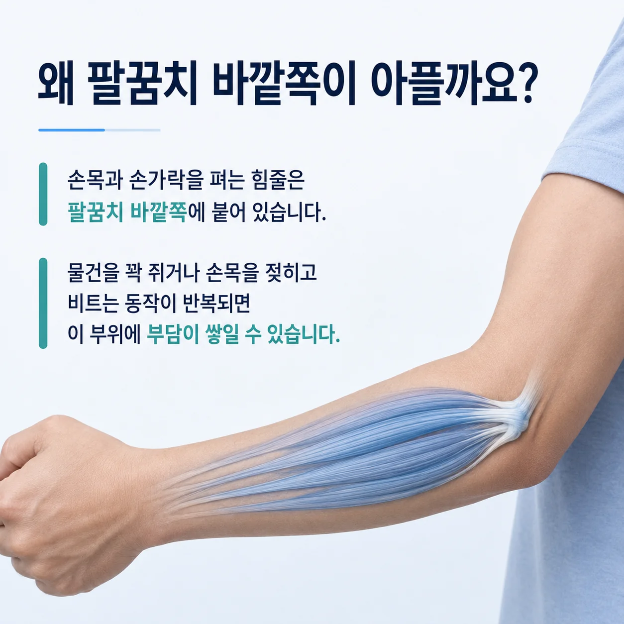 팔꿈치 바깥쪽 손목 폄근 힘줄 구조